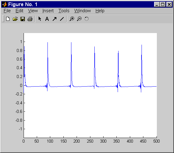 waveform